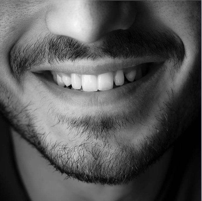 Dental Implants Los Alcázares